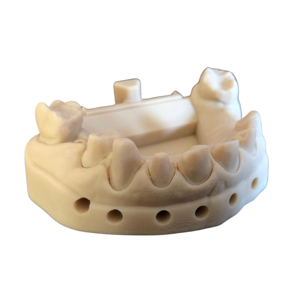 Precision dental 3D prints from intaprint3D